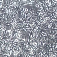 ES-2细胞系、ES2细胞、ES-2卵巢透明癌细胞