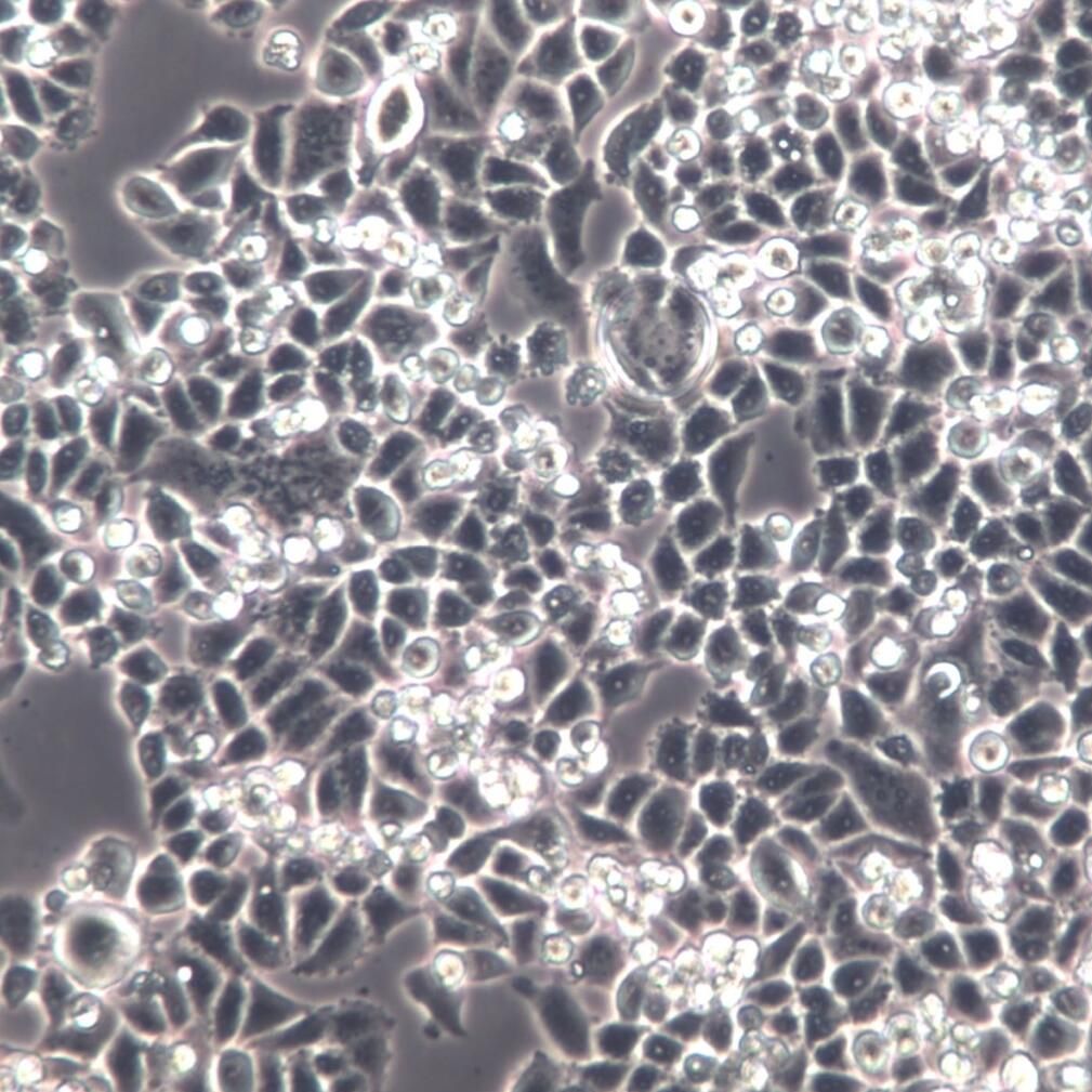 C-33A、C33A、C-33A细胞