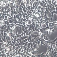 801-D细胞、801-D细胞系、801-D巨细胞性肺癌细胞