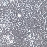 Calu-1细胞、Calu-1细胞系、Calu-1肺癌细胞