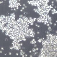 Farage细胞、Farage细胞系、FarageB淋巴瘤细胞