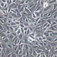 OS-RC-2细胞系、OS-RC-2细胞、OS-RC-2肾癌细胞