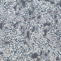 COLO320DM细胞、COLO320DM细胞系、COLO320DM结肠癌细胞)