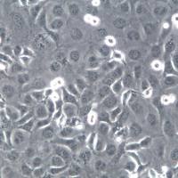 K1细胞系、K1细胞、K1甲状腺癌细胞