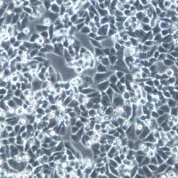 A-2780细胞系、A-2780细胞、A-2780卵巢癌细胞