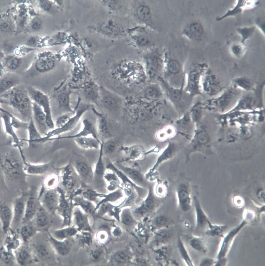 TE-1细胞系、TE-1细胞、TE-1食管癌细胞