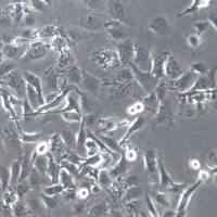 TE-1细胞系、TE-1细胞、TE-1食管癌细胞