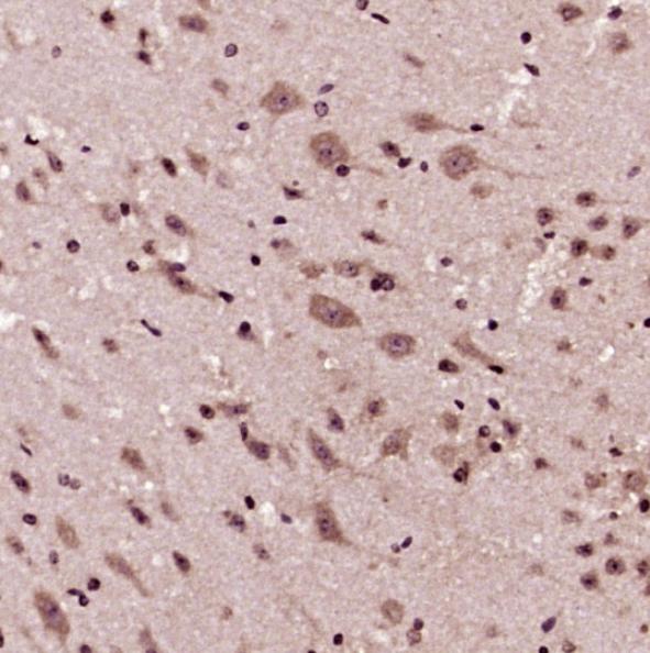 K010004P Anti-GSK3 Beta/GSK3B 