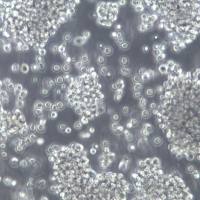 RAJI细胞、RAJI细胞系、RAJIBurkitt淋巴瘤细胞