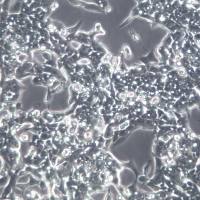 LoVo细胞系、LoVo细胞、LoVo结直肠腺癌细胞