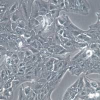 Li-7细胞系、Li-7细胞、Li-7肝癌细胞