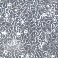 DMS114细胞系、DMS114细胞、DMS114小细胞肺癌细胞