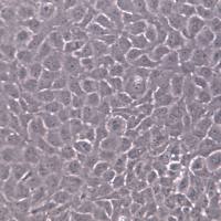 SRA01/04（HLE）细胞、SRA01/04（HLE）细胞系、SRA01/04（HLE）晶体上皮细胞永生系  