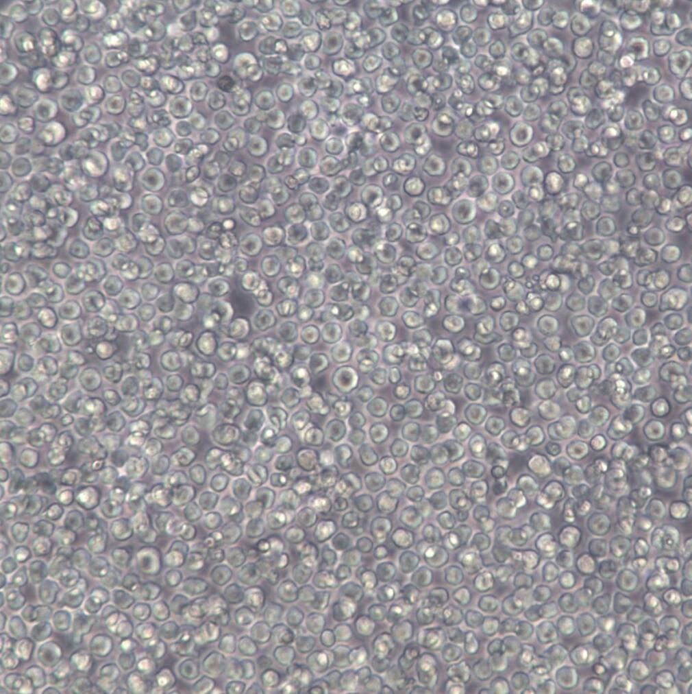 MOLM13细胞系、MOLM13细胞、MOLM13急性髓细胞样白血病细胞