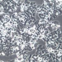 NCI-H520细胞株、NCI-H520细胞、NCI-H520肺鳞癌细胞  