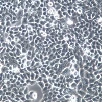 Tca-8113细胞系、Tca-8113细胞、Tca-8113舌鳞癌细胞