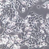 TMK-1细胞、TMK-1细胞系、TMK-1胃癌细胞