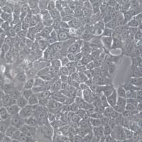 Kyse-520细胞系、Kyse-520细胞、Kyse-520食管鳞癌细胞