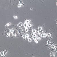 MuM-2B细胞系、MuM-2B细胞、MuM-2B侵袭性脉络膜黑色素瘤细胞 