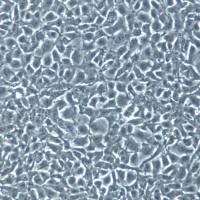 PA-1细胞系、PA-1细胞、PA-1卵巢畸胎瘤细胞