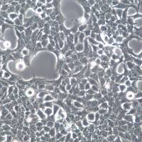 SACC-83细胞系、SACC-83细胞、SACC-83涎腺腺样囊性癌细胞