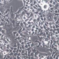 HuH-7细胞系、HuH7细胞、HuH-7肝癌细胞