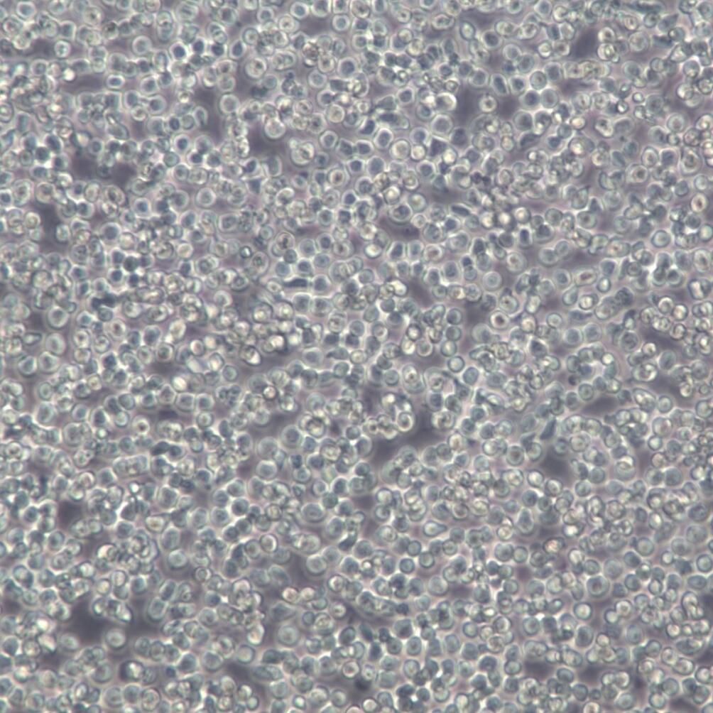 Ramos细胞、Ramos细胞系、RamosB淋巴细胞瘤细胞