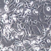 SK-HEP-1人肝癌细胞；SK-HEP-1细胞、SK-HEP-1