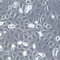 SCC-25细胞系、SCC-25细胞、SCC-25舌磷癌细胞