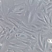 SW 1353细胞株、SW 1353细胞、SW 1353软骨肉瘤细胞
