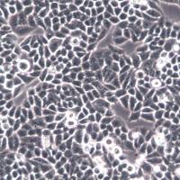 KB细胞系、KB细胞、KB口腔上皮癌细胞