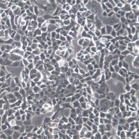 RPMI-2650 人鼻腔上皮细胞