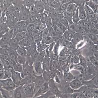 RT4细胞系、RT4细胞、RT4膀胱移行癌细胞