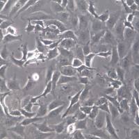 SK-OV-3细胞、SK-OV-3细胞系、SK-OV-3卵巢癌细胞