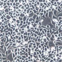 HCT-8/FU 细胞系、HCT-8/FU 细胞、HCT-8/FU 结肠癌氟尿嘧啶耐药株