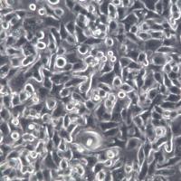 NCI-H1993细胞系、NCI-H1993细胞、NCI-H1993非小细胞肺癌细胞