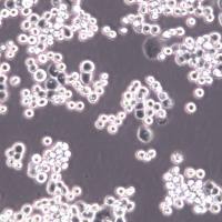 MDA-MB-453细胞系、MDA-MB-453细胞、MDA-MB-453乳腺癌细胞