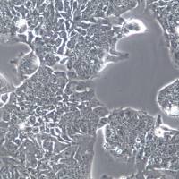 T84人结肠腺癌肺转移细胞；T84细胞、T84