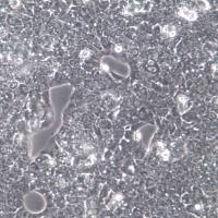 HepG2细胞系、HepG2细胞、HepG2肝癌细胞