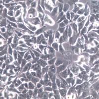 MHCC-97H细胞系、MHCC-97H细胞、MHCC-97H高转移肝癌细胞