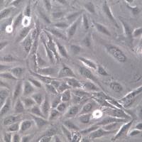 J82细胞系、J82细胞、J82膀胱癌细胞