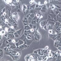 PLC/PRF/5细胞、PLC/PRF/5细胞系、PLC/PRF/5肝癌亚力山大细胞