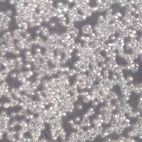 SUP-B15细胞株、SUP-B15细胞、SUP-B15Ph+急淋白血病细胞系