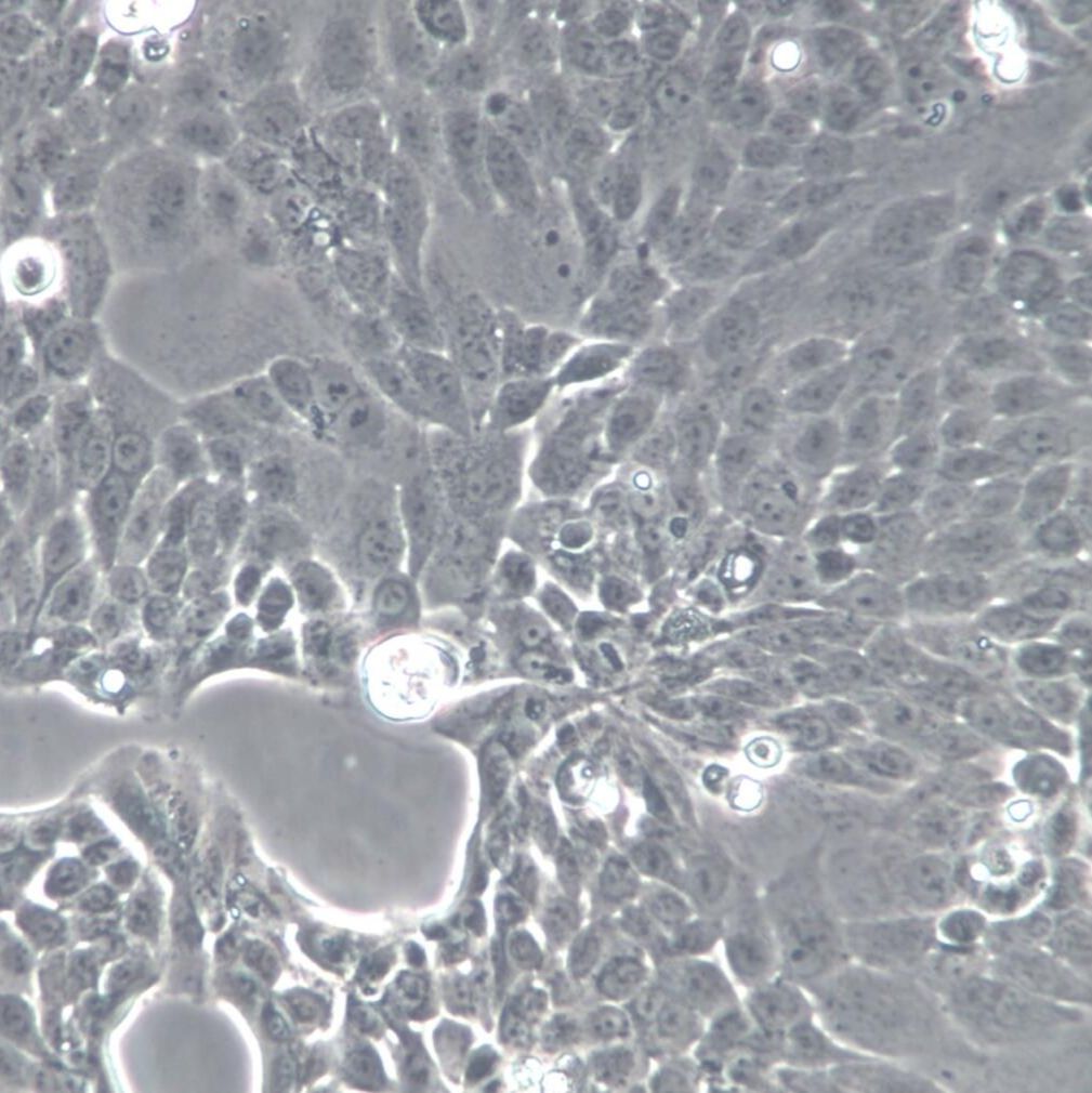PANC10.05细胞系、PANC10.05细胞、PANC10.05胰腺癌细胞