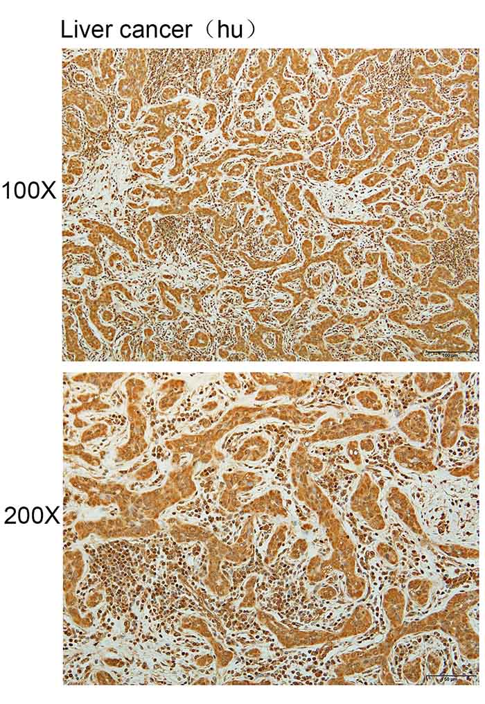 K114131P Anti-PFKFB1 Polyclona
