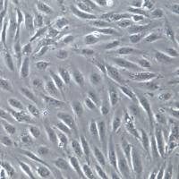 HUVEC细胞系、HUVEC细胞、HUVEC脐静脉血管内皮细胞