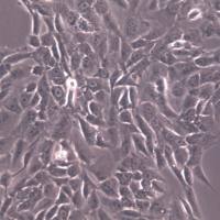 SK-N-AS细胞、SK-N-AS细胞系、SK-N-AS神经母细胞瘤细胞