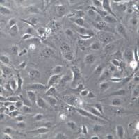 HMEC-1 细胞、HMEC-1 细胞系、HMEC-1 微血管内皮细胞株