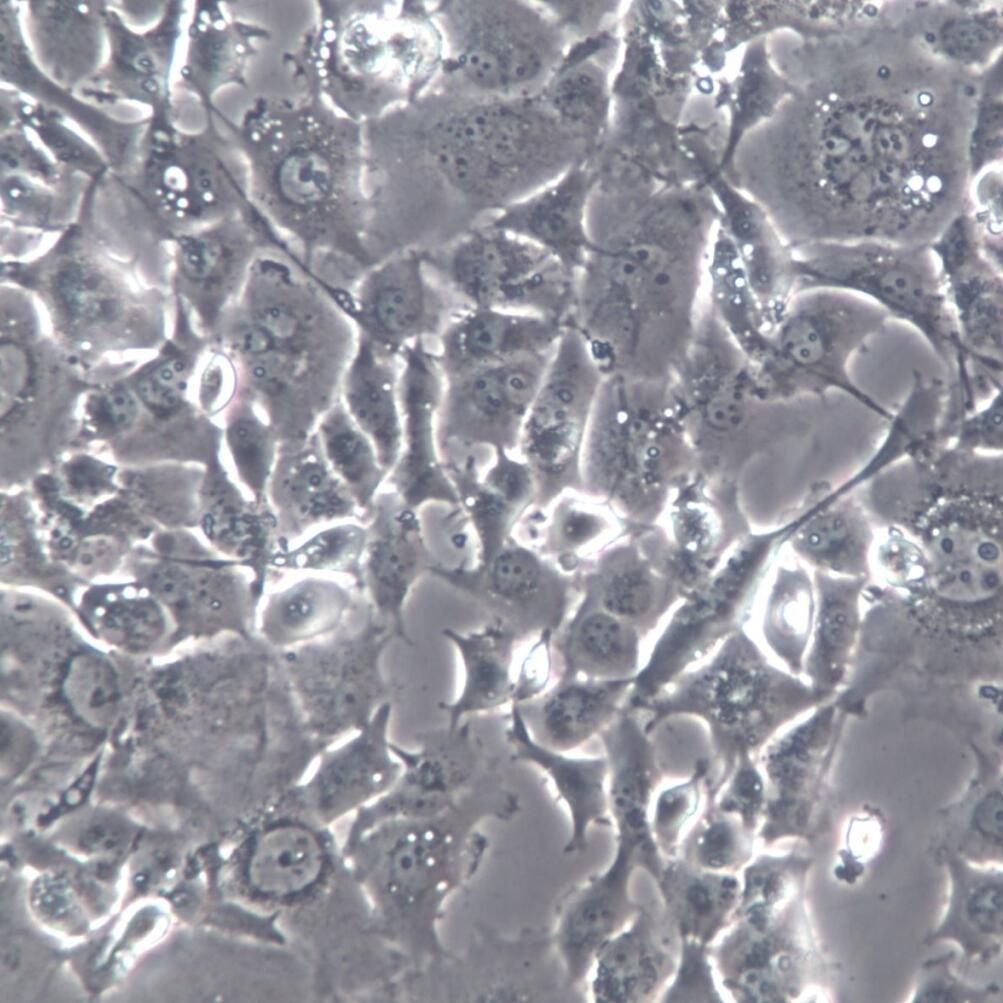 HS-746T 细胞系、HS-746T 细胞、HS-746T 胃癌细胞