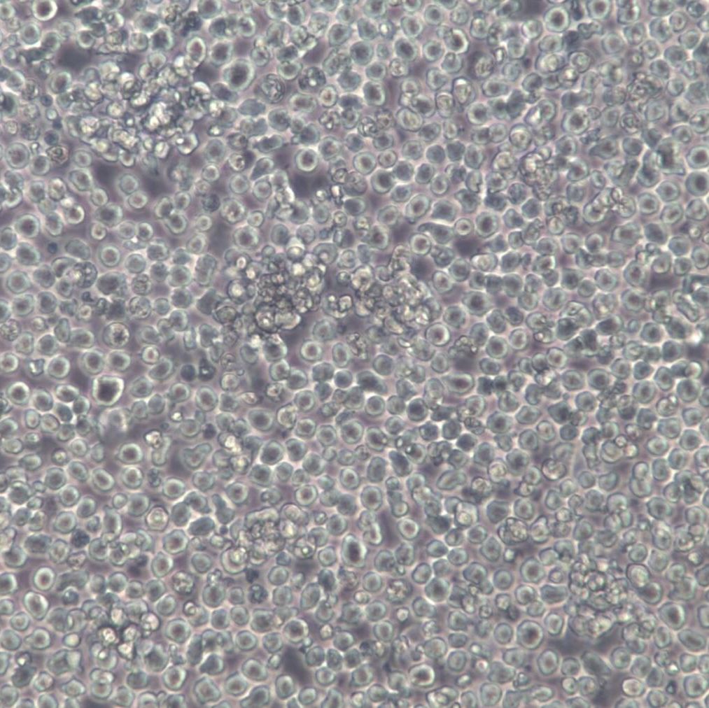 NB4细胞系、NB4细胞、NB4急性早幼粒白血病细胞